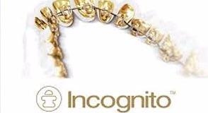 Incognito - innsideregulering