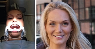 Komikerfrue på Tannregulering