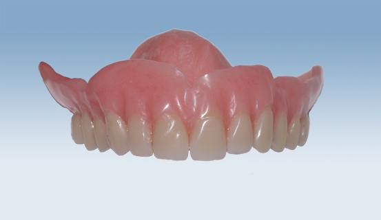 helprotese1